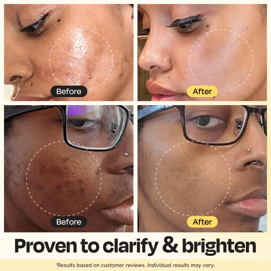 Vitamin C Clay Mask - Brighten & Clear Skin