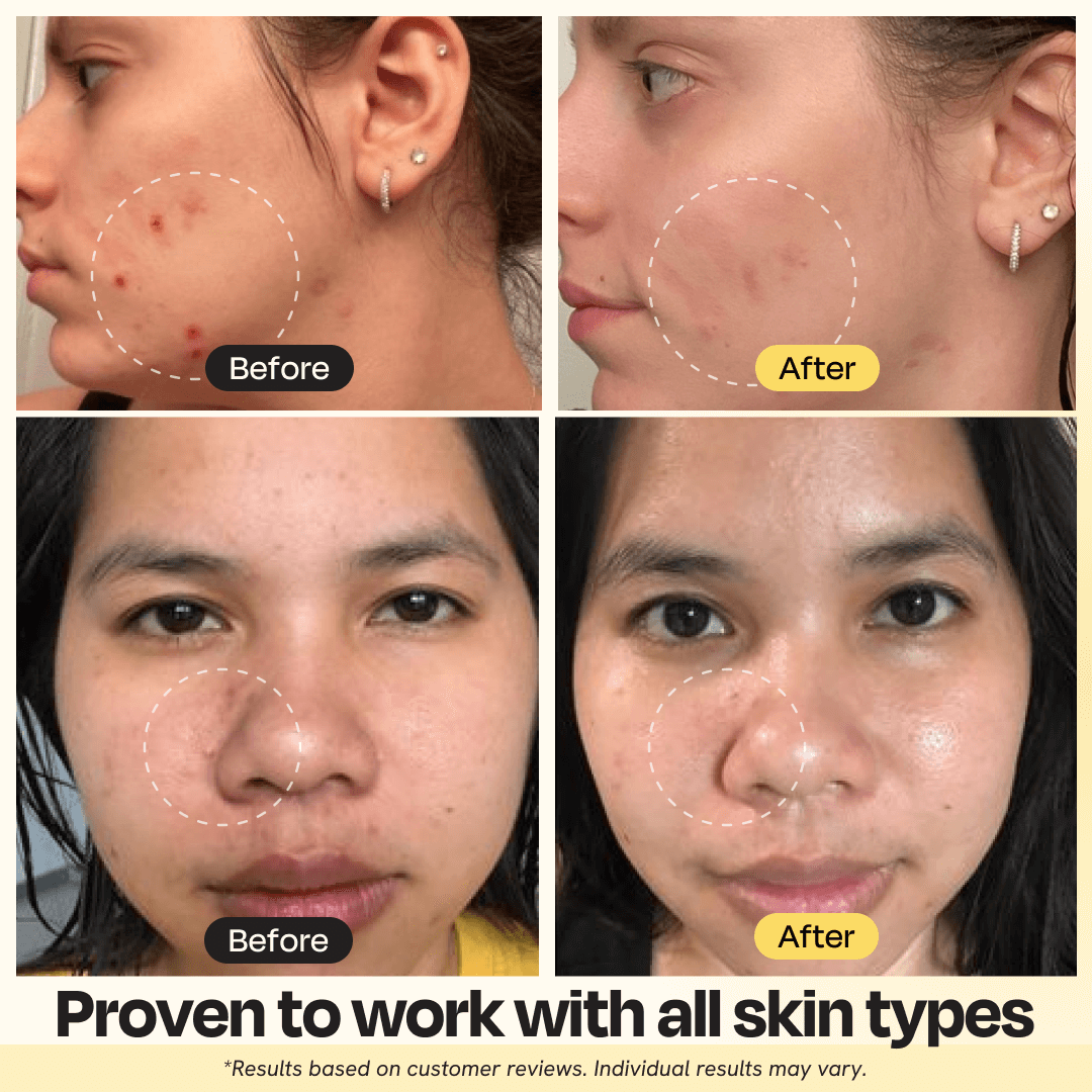 Vitamin C Clay Mask - Brighten & Clear Skin